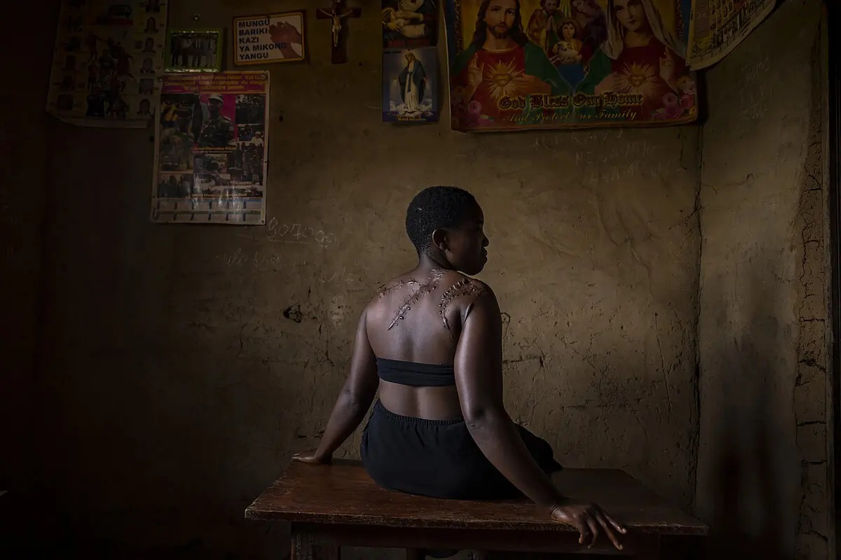 República Democrática do Congo: Abusos xeneralizados das Forzas Democráticas Aliadas contra civís
